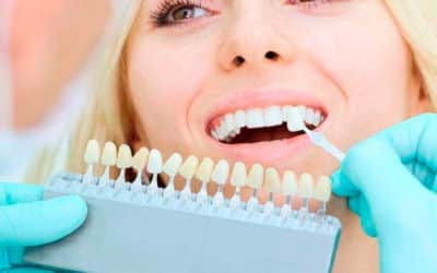 Un implant dentaire, tout ce qu’il faut savoir