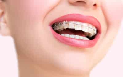 Les bienfaits des traitements orthodontiques